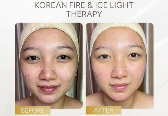10 Review Klinik Kecantikan di Jogja Murah, Simak Daftar Rekomendasi dan Alamatnya Ini